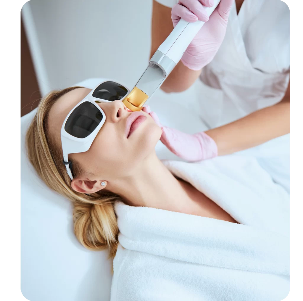 Laser treatment for hair removal, brown spots, rosacea, and stretch marks