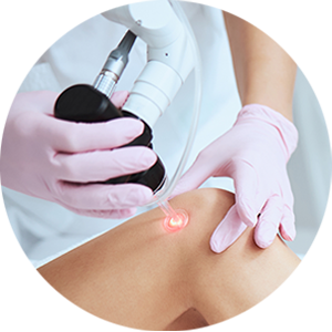 Sclerotherapy in boca raton